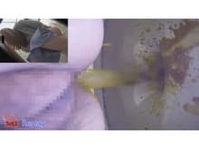 民家盗撮 食中毒下痢便 ～悶え苦しむ女達の姿～ サンプル画像 2