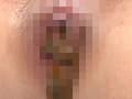 脱糞観察子宮いじり サンプル画像 9