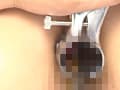 【裏録】男根用アナル締付筋拡張整体院 サンプル画像 6