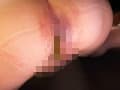 お金の為に人前でウンコしちゃった素人娘たち サンプル画像 3