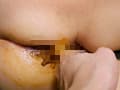 癒し系 かなちゃんのウンコ遊び初体験と肛門掻き出し糞 サンプル画像 9