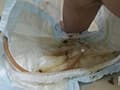 失禁病棟 おもらし治療SM 思春期病棟 サンプル画像 9