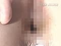 検便排泄クリニック3（7台マルチカメラ収録） サンプル画像 8