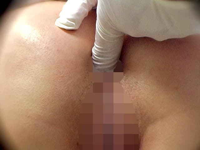 排泄羞恥診察 サンプル画像 6