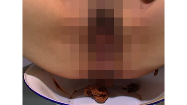 美肌活性腸内還元エステ うんこ塗りたくり発酵美容法 サンプル画像 12
