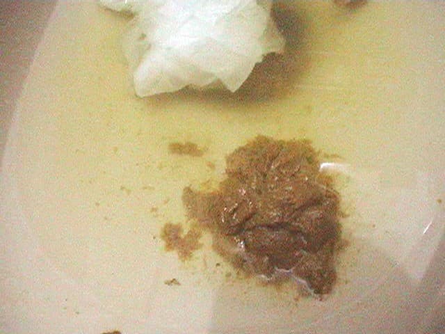 素人娘たちがお金欲しさに完全自画撮りでメリメリっと肛門を広げて浣腸を注入からのウンチ排泄！僕は投稿されたその映像を見てチ○ポがギンギンになり、思わず高価買取りしちゃいました！ サンプル画像 8