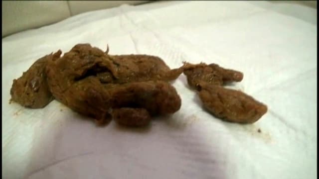 二十歳のウンチ生活 大人になってからの排泄の記録 サンプル画像 6