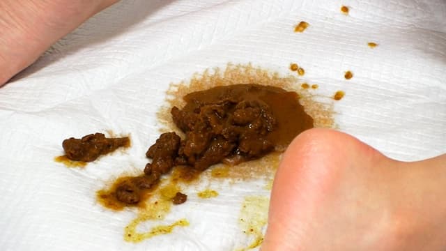 屁糞 2 サンプル画像 11